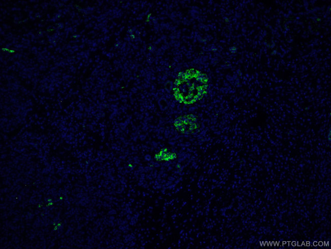 MMP7 Antibody in Immunohistochemistry (PFA fixed) (IHC (PFA))