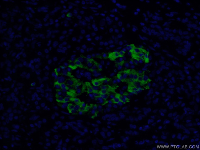 MMP7 Antibody in Immunohistochemistry (PFA fixed) (IHC (PFA))