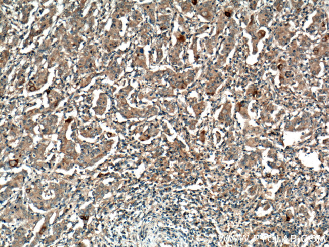 MMP7 Antibody in Immunohistochemistry (Paraffin) (IHC (P))