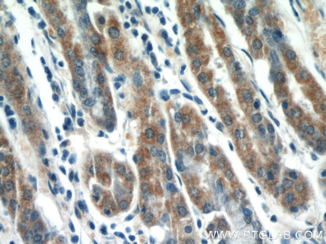 MMP7 Antibody in Immunohistochemistry (Paraffin) (IHC (P))