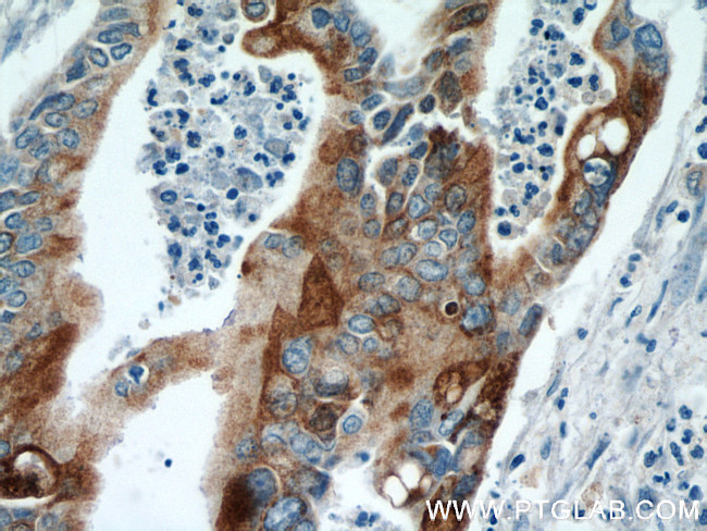 MMP7 Antibody in Immunohistochemistry (Paraffin) (IHC (P))