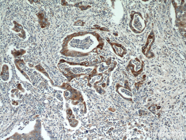 MMP7 Antibody in Immunohistochemistry (Paraffin) (IHC (P))