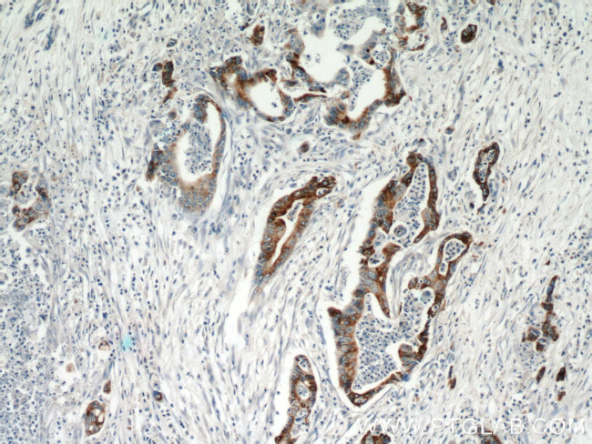 MMP7 Antibody in Immunohistochemistry (Paraffin) (IHC (P))