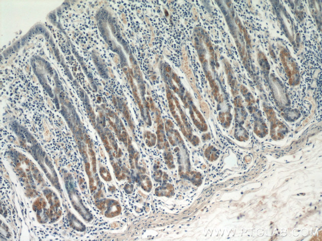 MMP7 Antibody in Immunohistochemistry (Paraffin) (IHC (P))