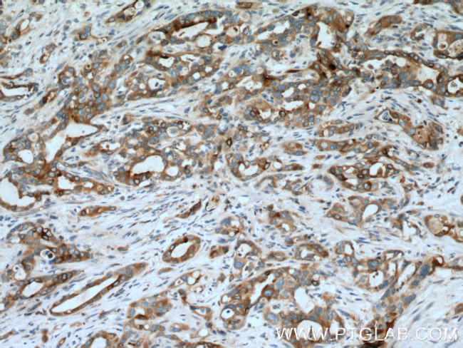 MMP7 Antibody in Immunohistochemistry (Paraffin) (IHC (P))