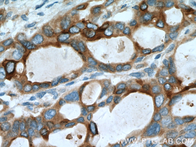 MMP7 Antibody in Immunohistochemistry (Paraffin) (IHC (P))