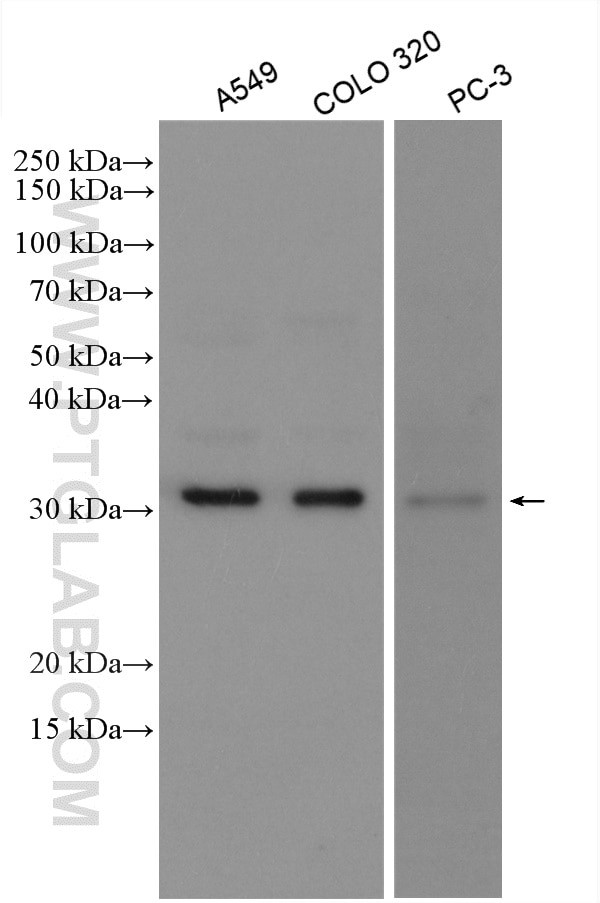 MMP7 Antibody in Western Blot (WB)