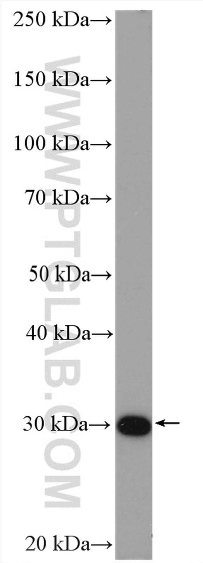 MMP7 Antibody in Western Blot (WB)