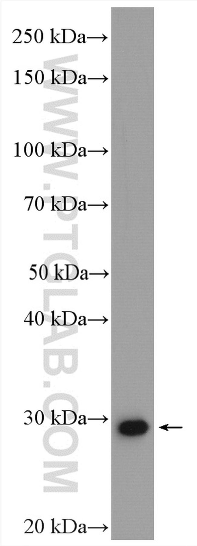 MMP7 Antibody in Western Blot (WB)