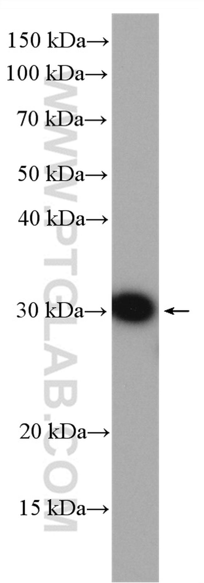 MMP7 Antibody in Western Blot (WB)