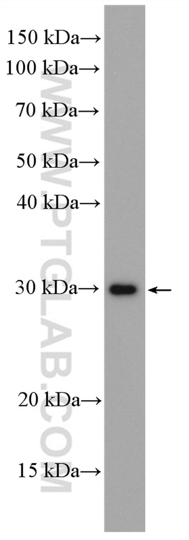 MMP7 Antibody in Western Blot (WB)