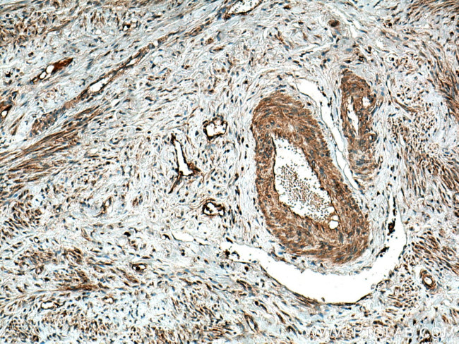 MMP9 (N-terminal) Antibody in Immunohistochemistry (Paraffin) (IHC (P))