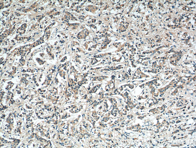 MMP9 (N-terminal) Antibody in Immunohistochemistry (Paraffin) (IHC (P))