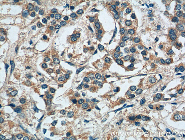 MMP9 (N-terminal) Antibody in Immunohistochemistry (Paraffin) (IHC (P))