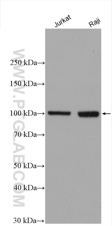 MMP9 (N-terminal) Antibody in Western Blot (WB)