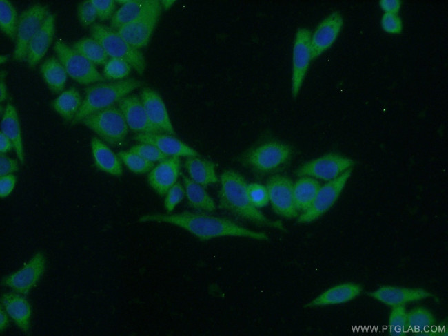 MMP9 (N-terminal) Antibody in Immunocytochemistry (ICC/IF)