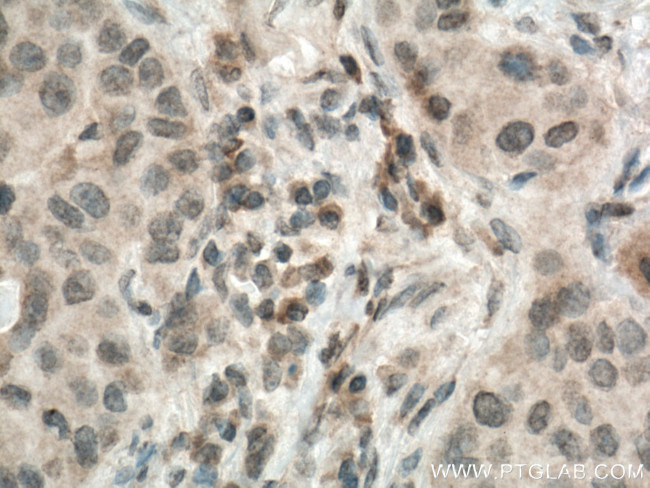 MMP9 (N-terminal) Antibody in Immunohistochemistry (Paraffin) (IHC (P))