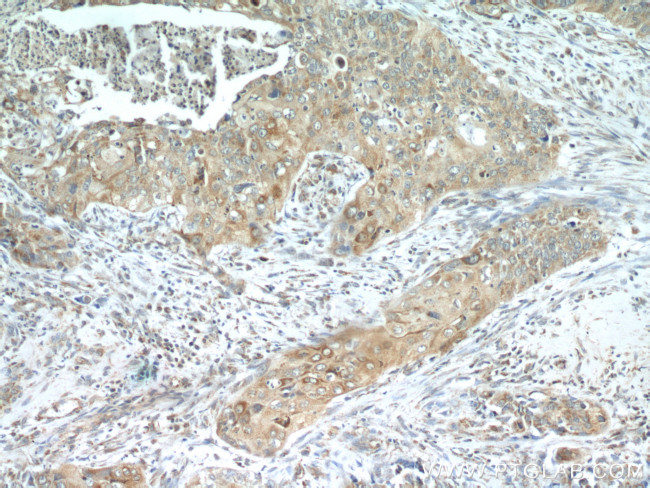 MMP9 (N-terminal) Antibody in Immunohistochemistry (Paraffin) (IHC (P))