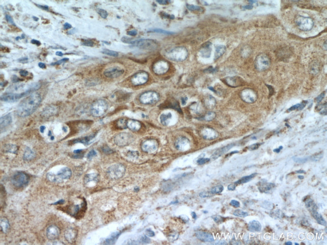 MMP9 (N-terminal) Antibody in Immunohistochemistry (Paraffin) (IHC (P))