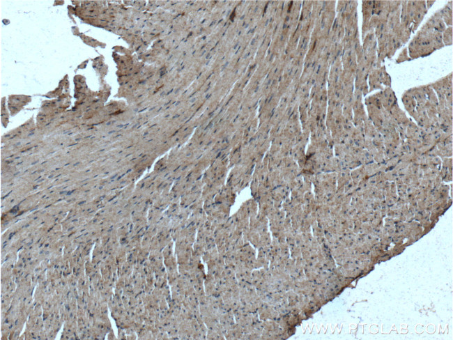 MMP9 (N-terminal) Antibody in Immunohistochemistry (Paraffin) (IHC (P))