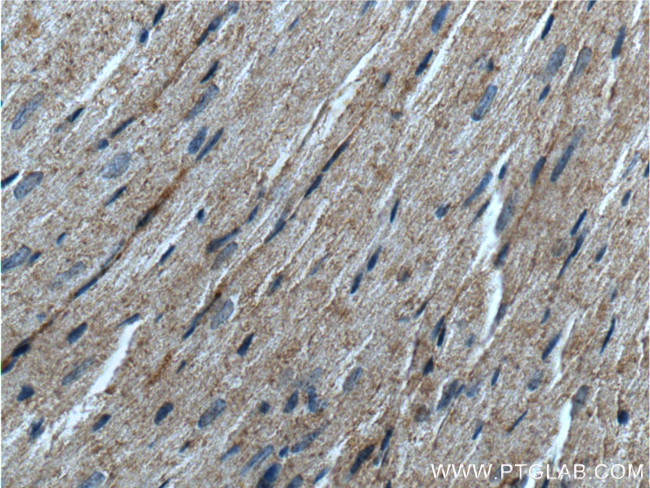 MMP9 (N-terminal) Antibody in Immunohistochemistry (Paraffin) (IHC (P))