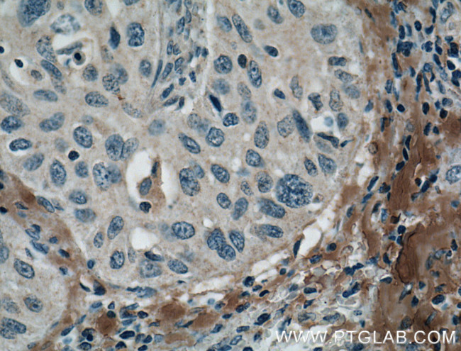 MMP9 (N-terminal) Antibody in Immunohistochemistry (Paraffin) (IHC (P))