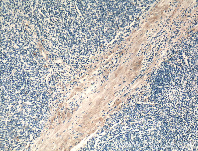 MMP9 (N-terminal) Antibody in Immunohistochemistry (Paraffin) (IHC (P))