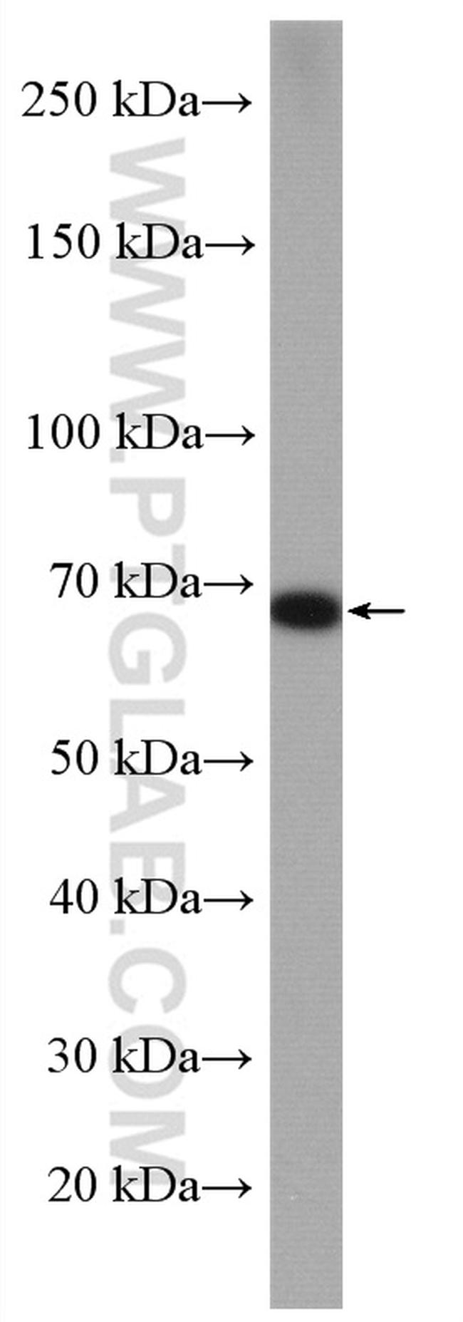 MMP9 (N-terminal) Antibody in Western Blot (WB)