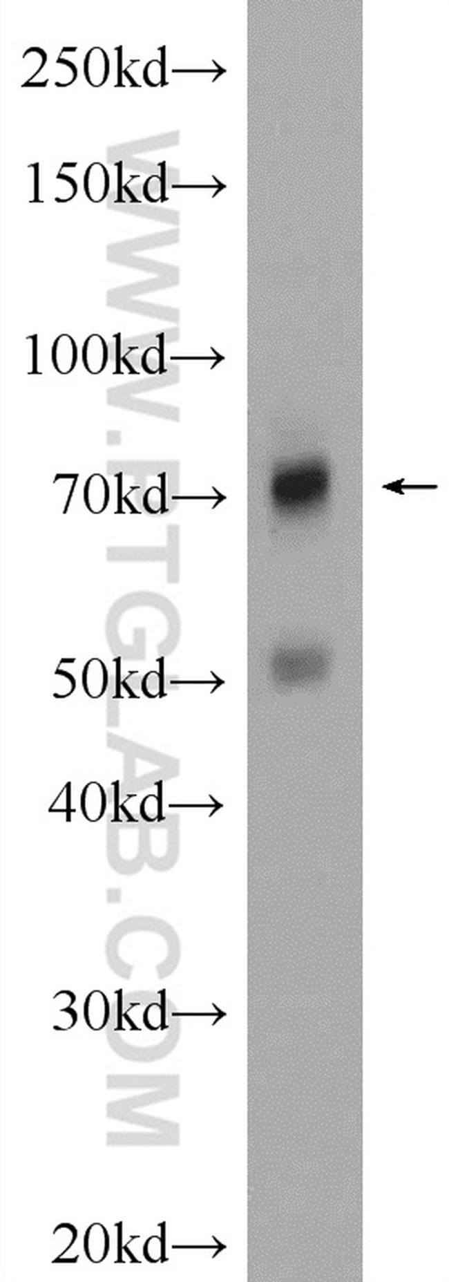 MMP9 (N-terminal) Antibody in Western Blot (WB)