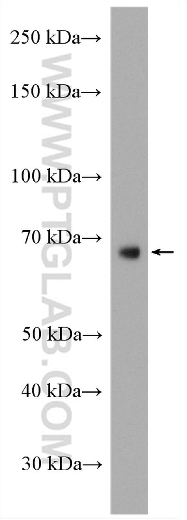 MMP9 (N-terminal) Antibody in Western Blot (WB)