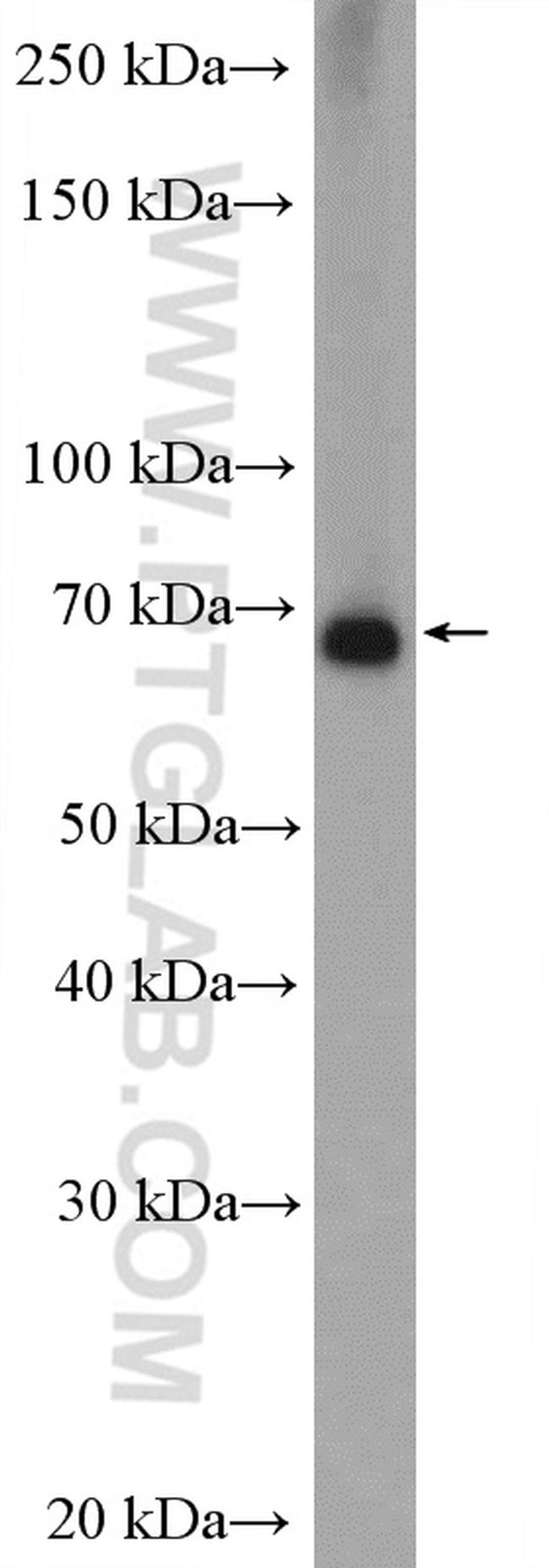 MMP9 (N-terminal) Antibody in Western Blot (WB)