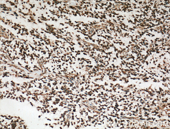 RAP1GDS1 Antibody in Immunohistochemistry (Paraffin) (IHC (P))