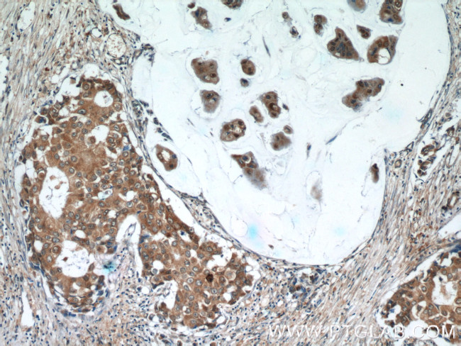 SNRPD3 Antibody in Immunohistochemistry (Paraffin) (IHC (P))