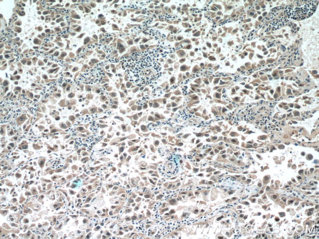 SNRPD3 Antibody in Immunohistochemistry (Paraffin) (IHC (P))