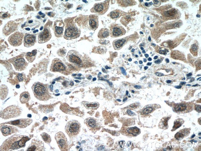 SNRPD3 Antibody in Immunohistochemistry (Paraffin) (IHC (P))