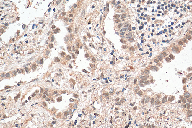 SNRPD3 Antibody in Immunohistochemistry (Paraffin) (IHC (P))