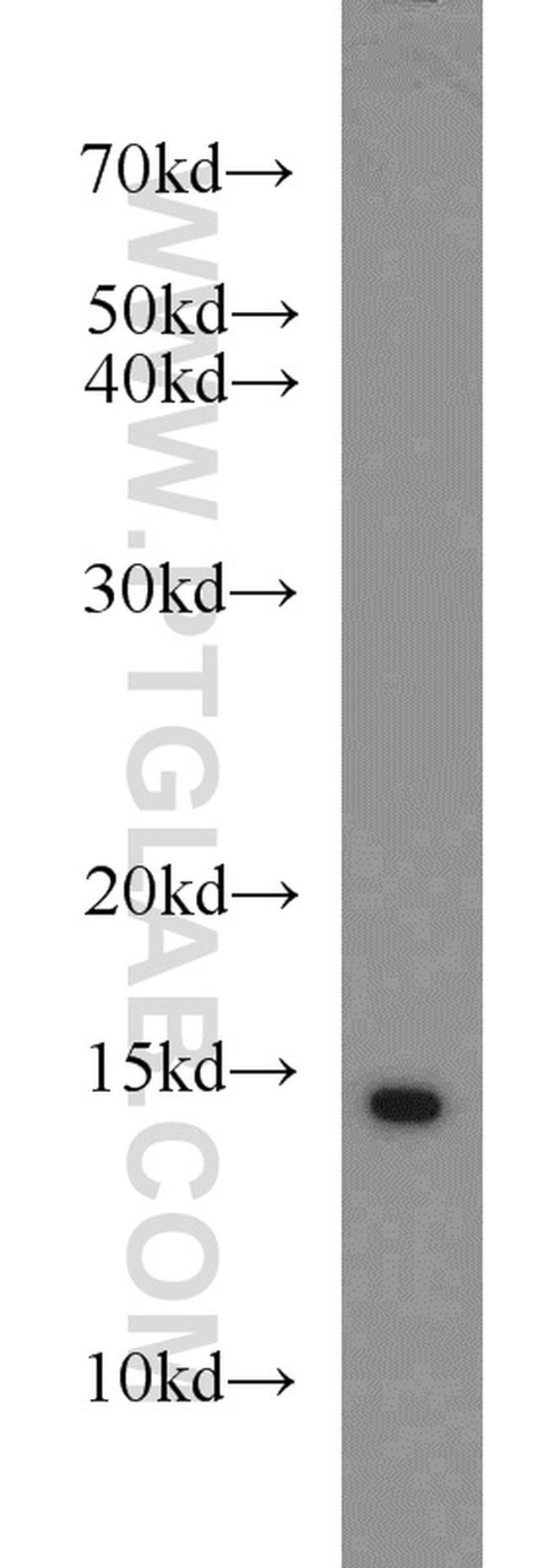 SNRPD3 Antibody in Western Blot (WB)