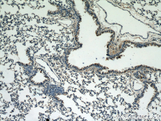 Caspase 9/p35/p10 Antibody in Immunohistochemistry (Paraffin) (IHC (P))