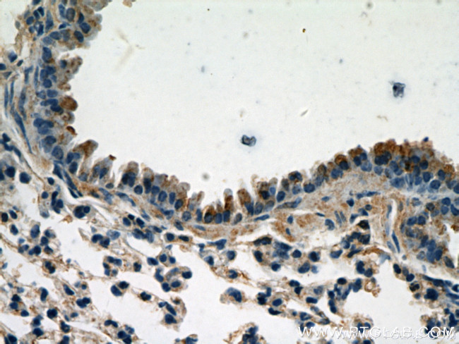 Caspase 9/p35/p10 Antibody in Immunohistochemistry (Paraffin) (IHC (P))