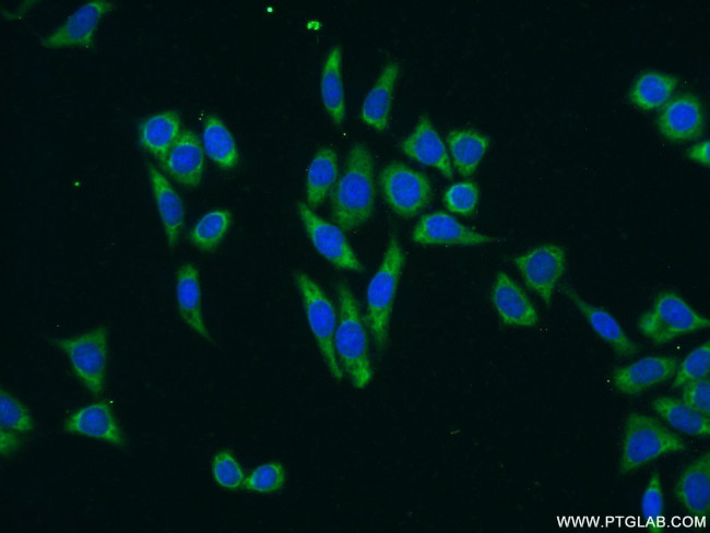 TTK Antibody in Immunocytochemistry (ICC/IF)