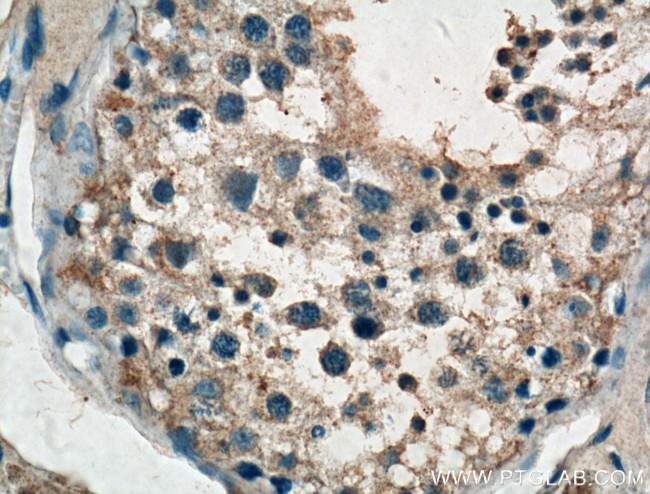 TTK Antibody in Immunohistochemistry (Paraffin) (IHC (P))