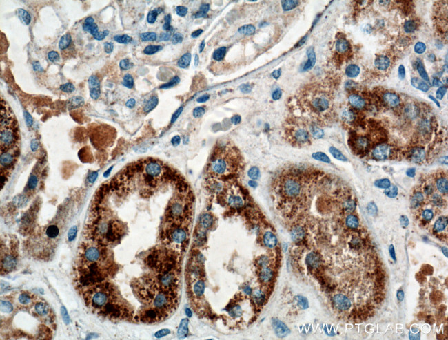 TTK Antibody in Immunohistochemistry (Paraffin) (IHC (P))