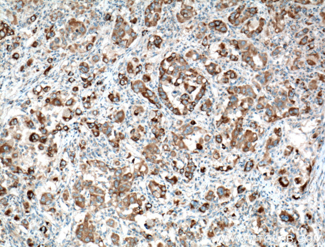 TTK Antibody in Immunohistochemistry (Paraffin) (IHC (P))