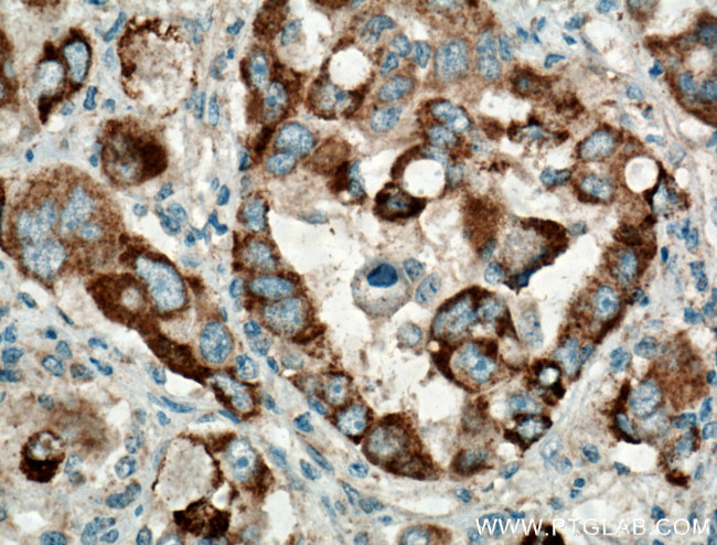 TTK Antibody in Immunohistochemistry (Paraffin) (IHC (P))