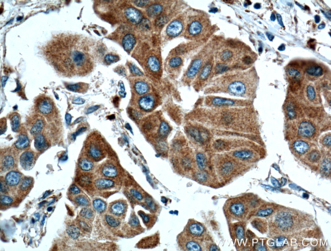 TTK Antibody in Immunohistochemistry (Paraffin) (IHC (P))