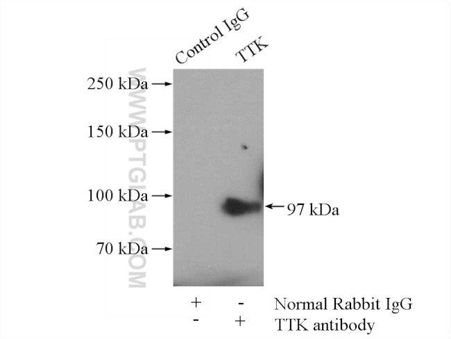 TTK Antibody in Immunoprecipitation (IP)