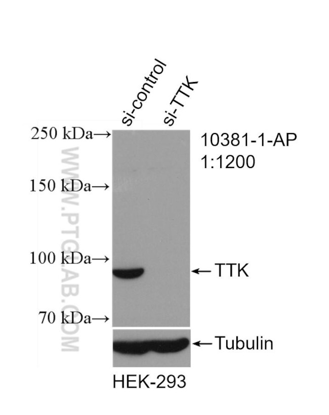 TTK Antibody in Western Blot (WB)