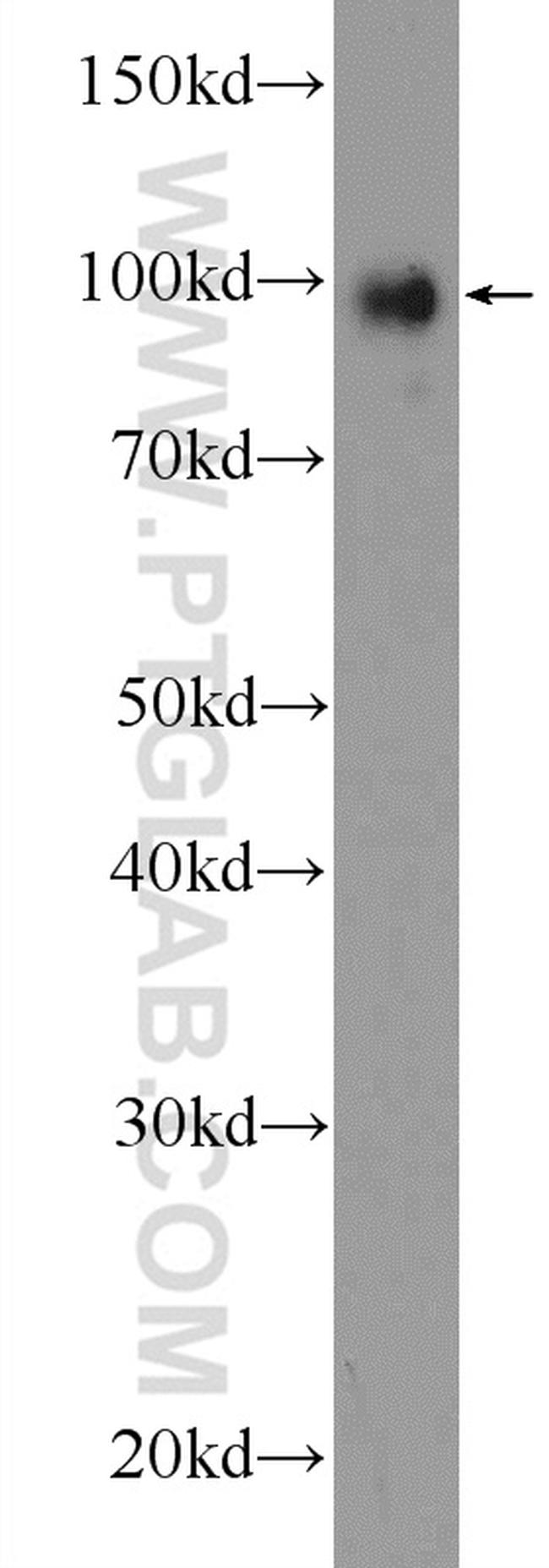 TTK Antibody in Western Blot (WB)