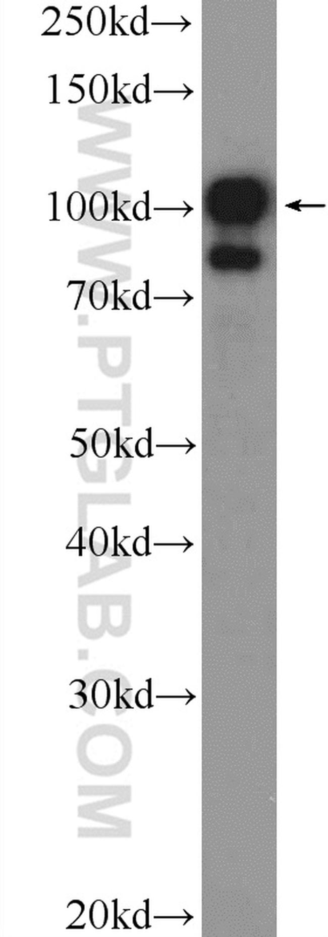 TTK Antibody in Western Blot (WB)