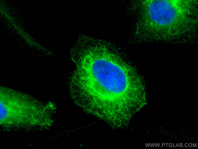 Cytokeratin 8 Antibody in Immunocytochemistry (ICC/IF)